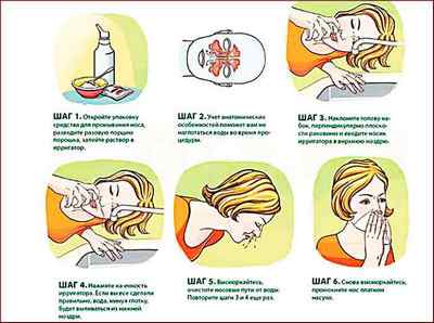 Викривлення носової перегородки: симптоми, лікування, наслідки
