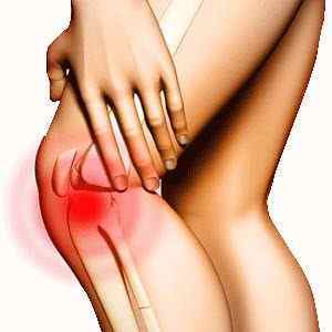 Вилетіла колінної чашечки: що робити якщо вискакує коліно з суглоба і встає на місце, як вибрати фіксатор суглоба | Ревматолог