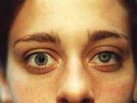 Випадання полів зору: причини, симптоми і лікування