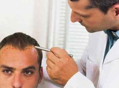 Випадання волосся у чоловіків (в молодому віці і не тільки): причини і лікування