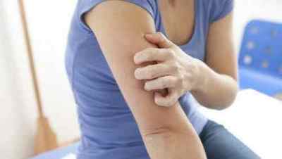 Висип і свербіж шкіри при гепатиті: ознаки і лікування