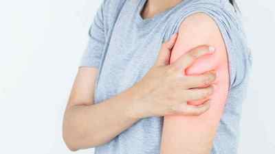 Вивихи плеча: симптоми і лікування після вправлення, вправити самостійно в домашніх умовах | Ревматолог