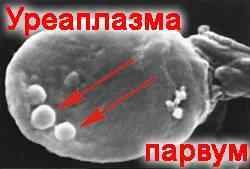 Виявлено Ureaplasma Parvum: ДНК, що це означає і чи треба лікувати