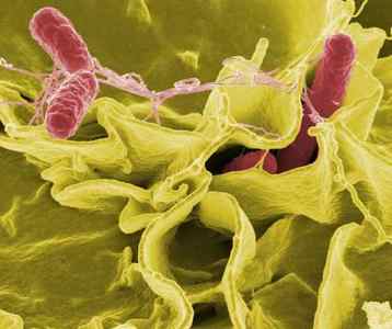 Властивості палички ботулізму і харчове отруєння, як вбити бактерію