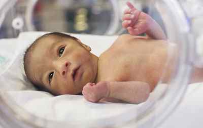 Внутрішньоутробна пневмонія у новонароджених: причини і наслідки