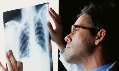 Вогнищевий туберкульоз легень: що це таке, симптоми, лікування