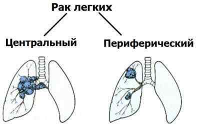 Вплив куріння на органи дихання людини