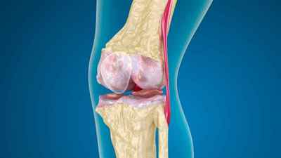 Вправа ходьба на колінах: користь чи шкода, чи можна при артрозі колінного суглоба, відгуки, користь для жінок | Ревматолог
