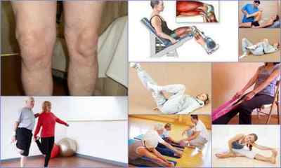 Вправи для колінного суглоба при артрозі для літніх людей
