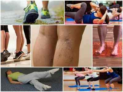 Вправи при варикозі вен нижніх кінцівок - лікувальна гімнастика для ніг