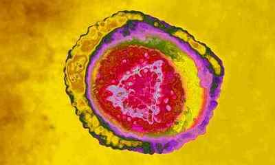 Вірус простого герпесу 1 і 2 типу: симптоми і лікування