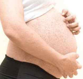 Вірус Rubella: симптоми і ознаки краснухи у вагітних
