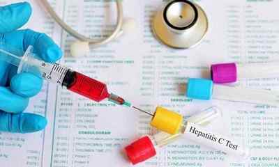 Вірусне навантаження при гепатиті С: методи визначення та розшифровка аналізів
