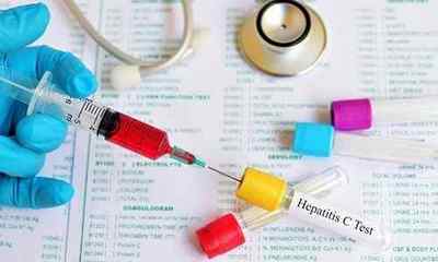 Вірусне навантаження при гепатиті С: розшифровка показників