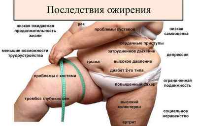 Вісцеральні ожиріння у чоловіків і жінок