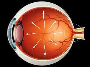 Вторинна глаукома (неоваскулярная, факсогенная): лікування, чи є можливість відновити зір