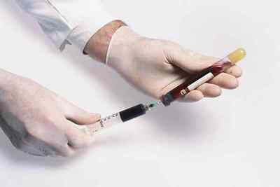 Вторинний діабет: симптоми, лікування і ознаки