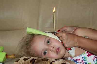 Вушні свічки: інструкція для дорослих і дітей по застосуванню від пробок, при закладеності і отиті