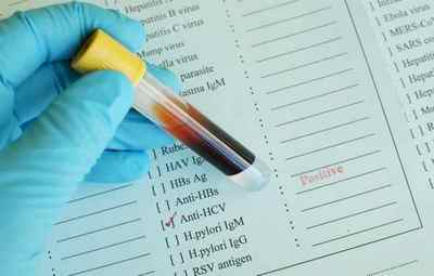 Які аналізи показують гепатит С
