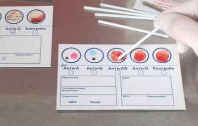 Як дізнатися свою групу крові і резус-фактор в домашніх умовах