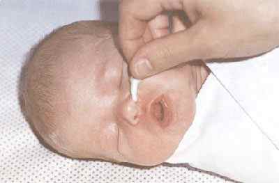 Які краплі в ніс для новонароджених дітей при нежиті краще використовувати
