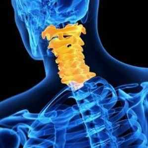 Як лікувати стеноз хребетного каналу шийного відділу | Ревматолог