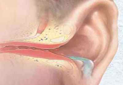 Як називається лікар, лікуючий вуха і перевіряючий слух