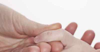 Як позбутися від бородавок у дітей на пальцях в домашніх умовах? Фото наростів на руках і ногах
