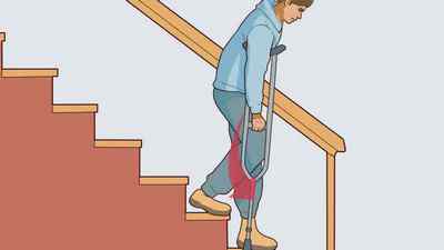 Як правильно ходити на милицях: як підніматися і спускатися по сходах, милиці для літніх людей, перейти на тростину | Ревматолог