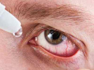 Як правильно закапувати краплі в очі: алгоритм і техніка закапування очних крапель
