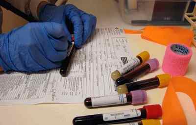 Як правильно здати аналіз крові на онкомаркери