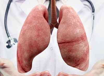 Як приймати борсуковий жир при туберкульозі легень