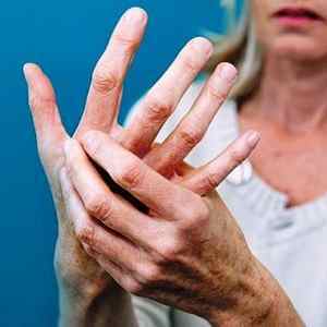 Як приймати Метипред при ревматоїдному артриті: відгуки, дозування і як знизити дозу | Ревматолог