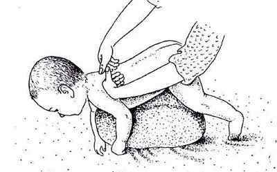 Як робити масаж при кашлі у дитини для відходження мокроти