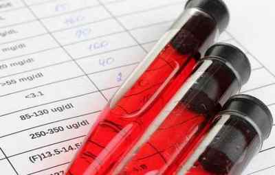 Як розшифрувати біохімічний аналіз крові
