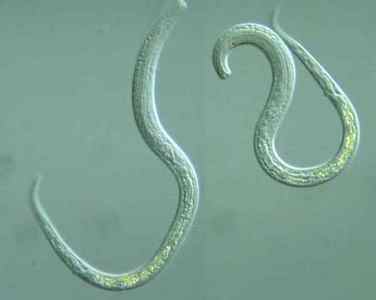 Як виглядають глисти в калі у людини: фото паразитів в організмі