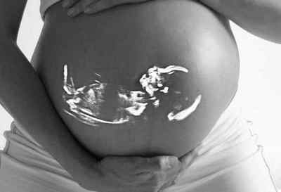 Як виходять гематоми при вагітності