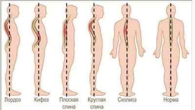 Як визначити болять нирки або спина?