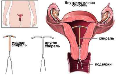 Як визначити лейоміому матки: ознаки патології, як лікувати