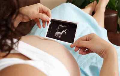 Як впоратися з субсерозной міому матки при вагітності