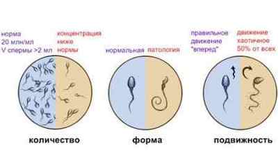 Яка повинна бути сперма (колір і інші показники)