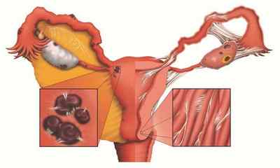 Яка товщина ендометрію є нормою на ранній стадії вагітності?