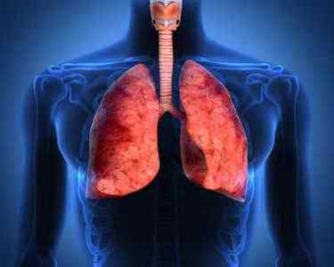 Який кашель при раку легенів і як його полегшити