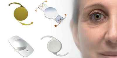 Який кришталик краще для операції при катаракті: відгуки, які бувають