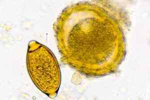 Яйця гельмінтів в калі: фото під мікроскопом, що це таке, симптоми і лікування