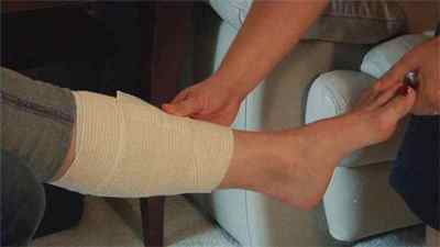 Забій гомілки: як лікувати сильний удар кістки на нозі, гематома після удару, шишка після травми і пошкодження окістя | Ревматолог
