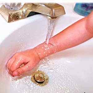 Забій пальця на руці або нозі: що робити, як і чим лікувати сильний удар мізинця в домашніх умовах, симптоми і перша допомога | Ревматолог