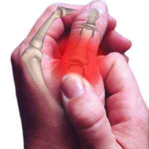 Забій пальця на руці або нозі: що робити, як і чим лікувати сильний удар мізинця в домашніх умовах, симптоми і перша допомога | Ревматолог