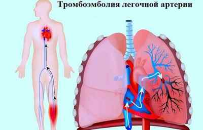 Захворювання органів дихання та їх симптоми