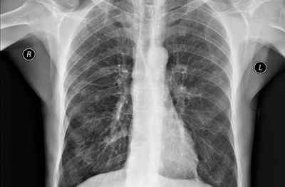 Захворювання органів дихання та їх симптоми